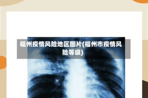 福州疫情风险地区图片(福州市疫情风险等级)